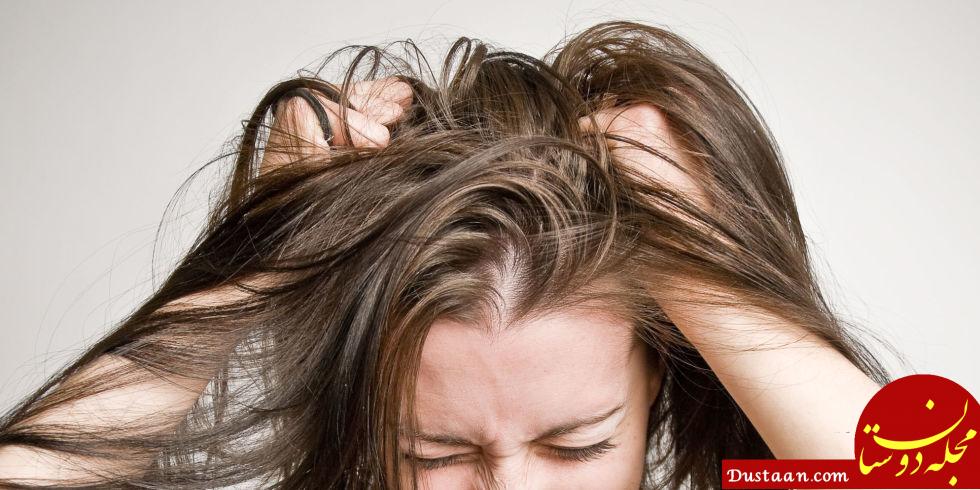 دلایل اصلی خارش سر چیست؟ + راه های درمان