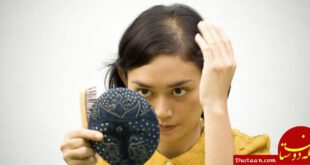 1-درمان ریزش موی جلوی سر دربانوان با استفاده از خوراکی‌های طبیعی+ تصاویر2-درمان ریزش موی هورمونی دربانوان با استفاده از خوراکی‌های طبیعی+ تصاویر