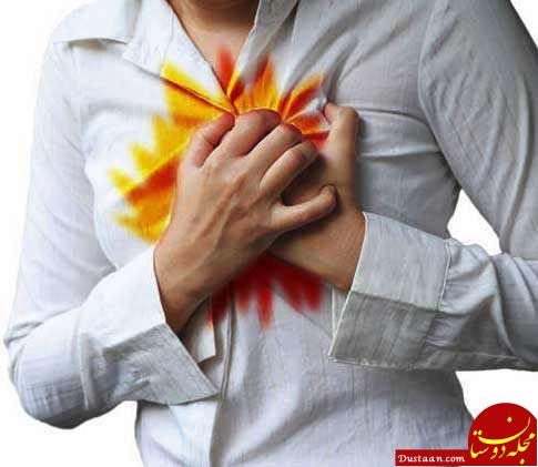 Image result for ‫رفلاکس معده‬‎