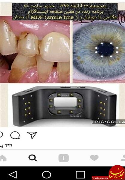 پخش زنده جراحی در اینستاگرام