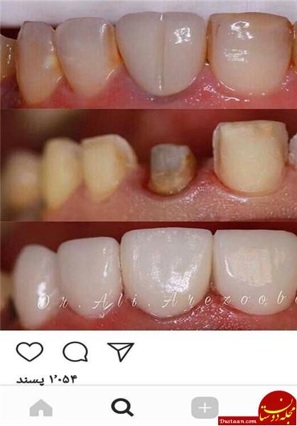 پخش زنده جراحی در اینستاگرام