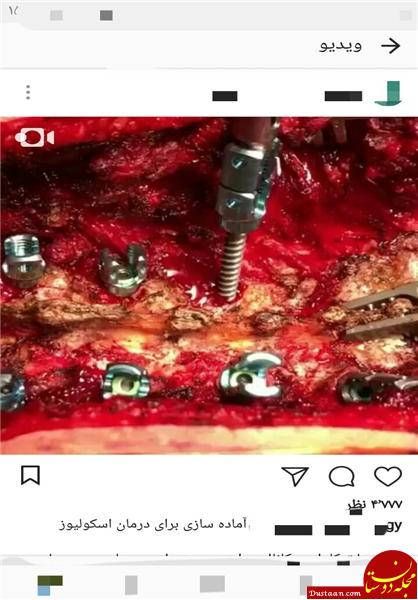 پخش زنده جراحی در اینستاگرام پخش زنده جراحی در اینستاگرام