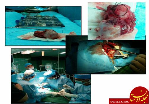 نجات نوزاد سه ماهه پس از دو بار سکته قلبی