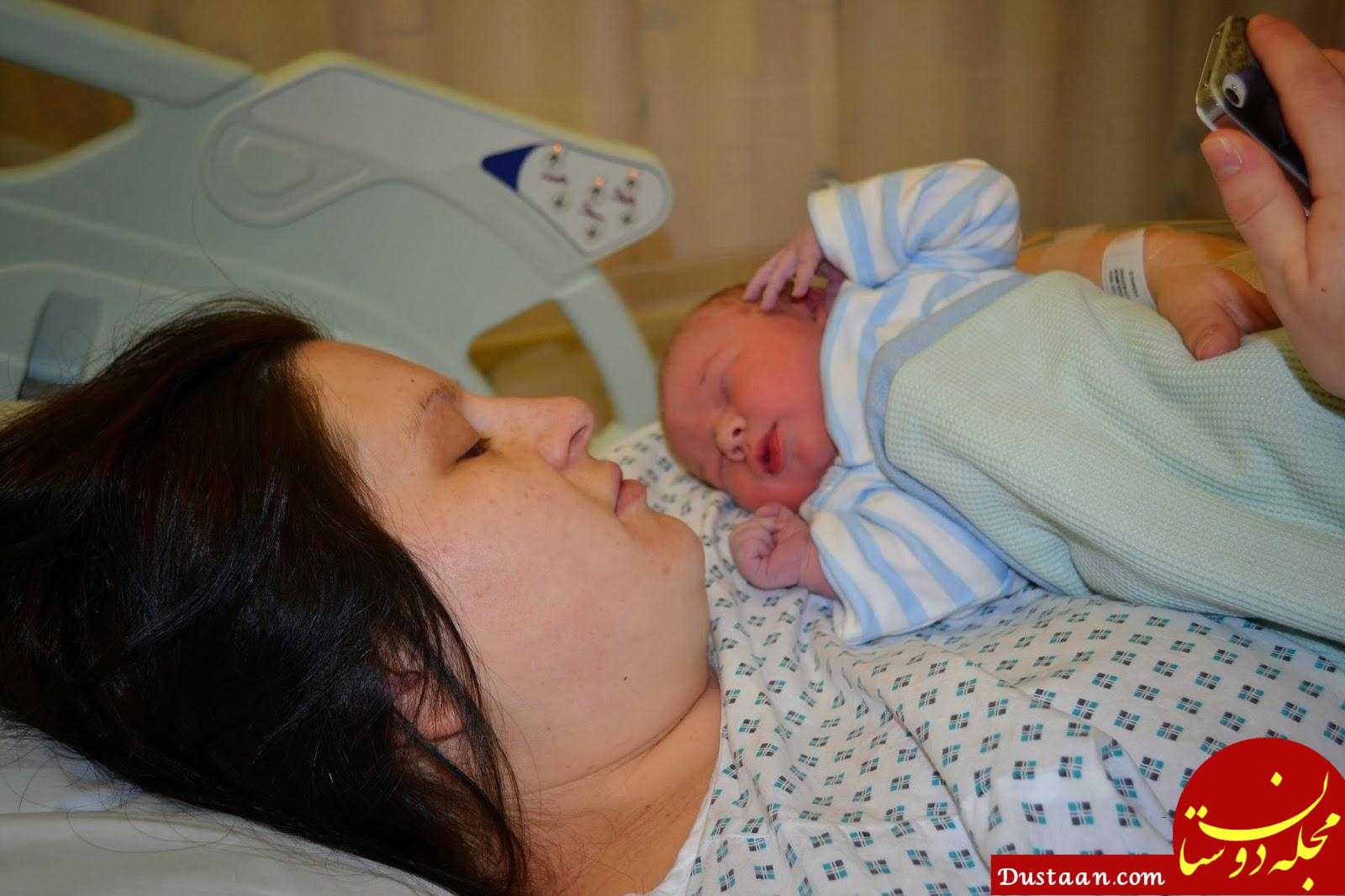 نتیجه تصویری برای عوارض زایمان سزارین