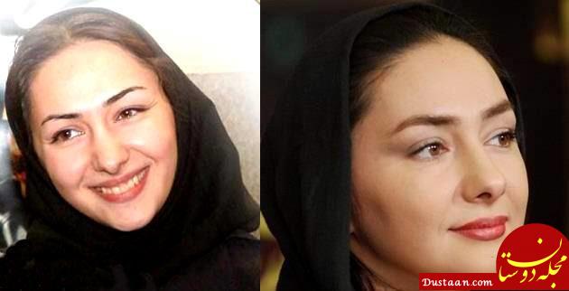 «هانیه توسلی» قبل و بعد از عمل زیبایی