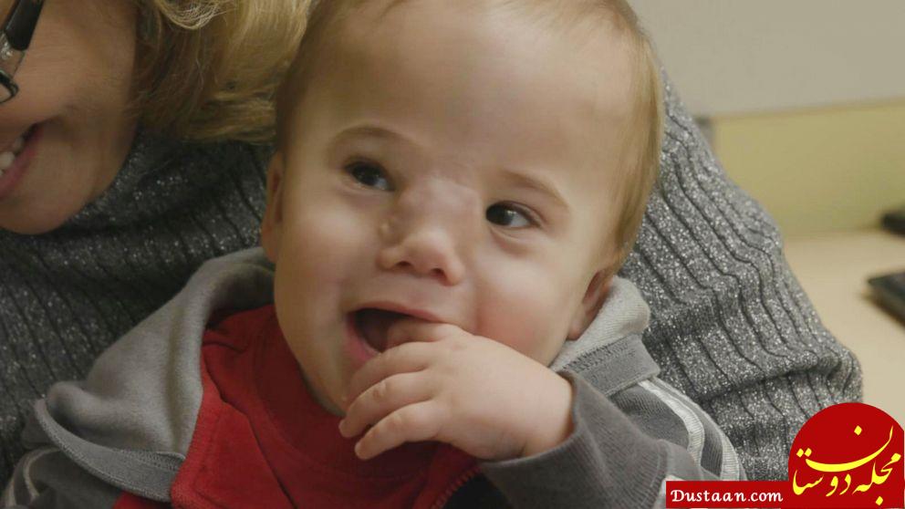 بیماری عجیب یک کودک پزشکان را به چالش کشید+تصاویر