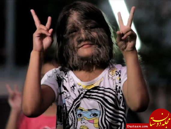 www.dustaan.com-زشت ترین دختر جهان هم به خانه بخت رفت! +تصاویر