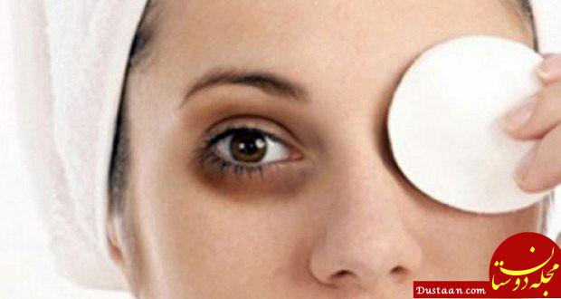 http://www.funvilla.pk/wp-content/uploads/2014/09/Ways-to-Get-Rid-of-Black-Circles-Under-Your-Eyes.jpg