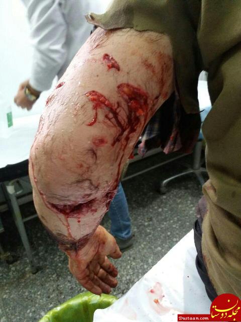 حمله وحشتناک پلنگ خشمگین به مرد زنجانی! +عکس www.dustaan.com حمله وحشتناک پلنگ خشمگین به مرد زنجانی! +عکس