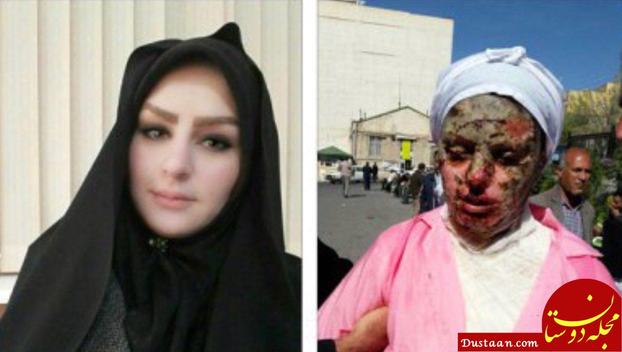 www.dustaan.com-گفتگو با معصومه ۲۶ ساله که خواستگارش شب عید به صورتش اسید پاشید