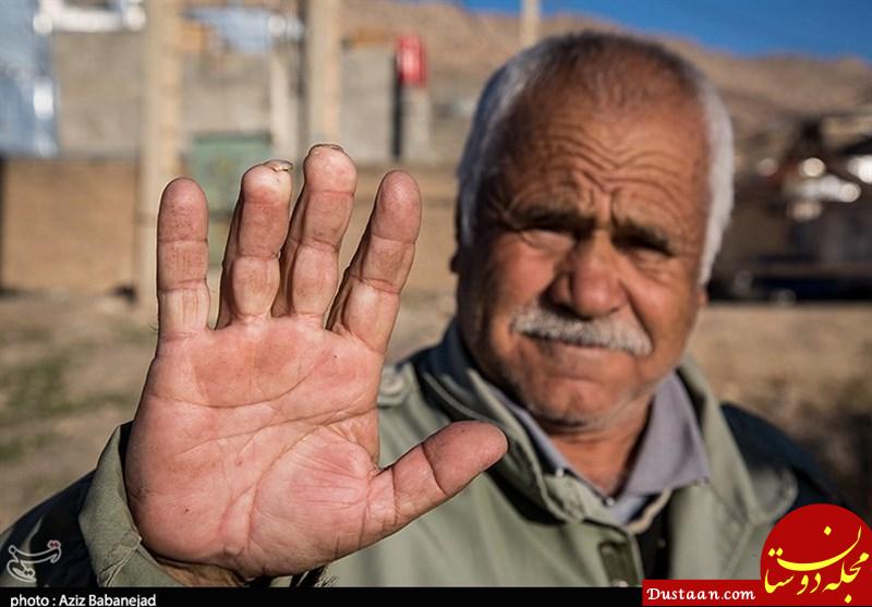 www.dustaan.com-قطع انگشت کرایه عبور مردم ابراهیم آباد؛ ” دست‌های بریده” به پل می‌رسد+تصاویر
