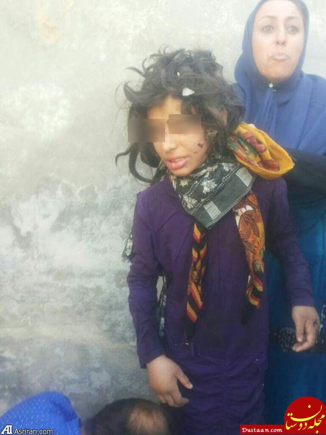 جزئیات شکنجه 3 کودک در ماهشهر با چکش و میله داغ / شکستگی بدن و دندان ها / پدر بازداشت شد +عکس و فیلم