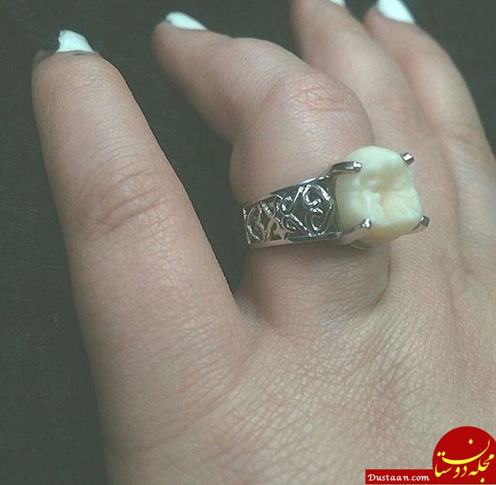 http://viral.dog/wp-content/uploads/2015/11/wisdom-tooth-engagement-ring-carlee-leifkes-lucas-unger-24.jpg