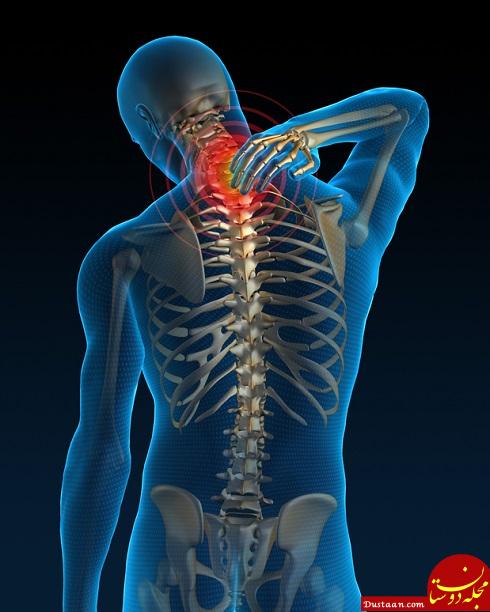 neck-pain02.jpg