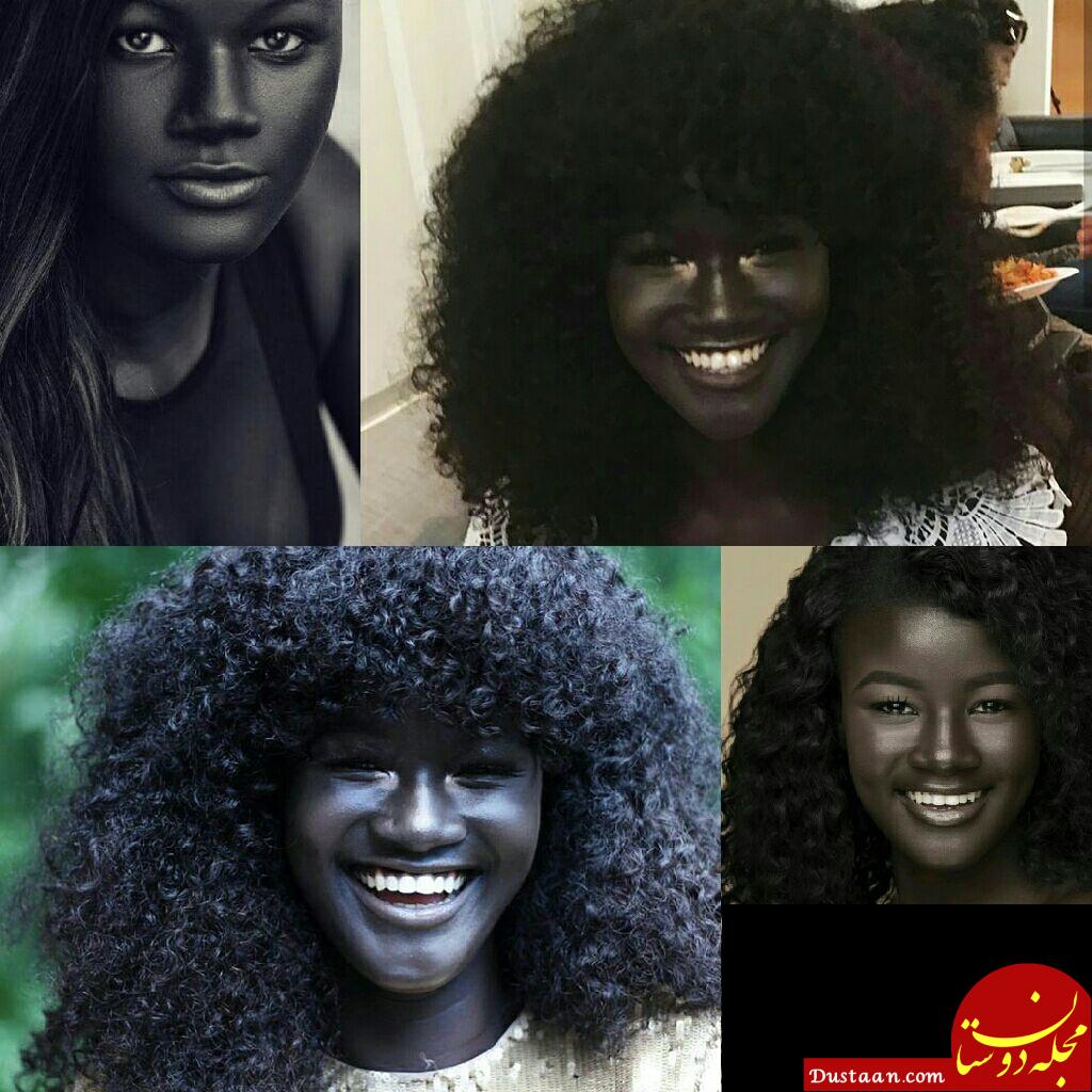 www.dustaan.com دختر زیبایی که سیاه ترین پوست جهان را دارد! +تصاویر