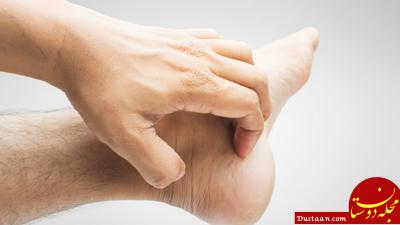 بیماری پای ورزشکار،درمان سریع خارش پا خارش پا ها در زمستان, دارو برای خارش پا