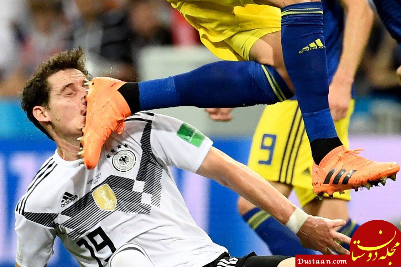 عکس: لحظه ترس آور شکسته شدن بینی بازیکن آلمان