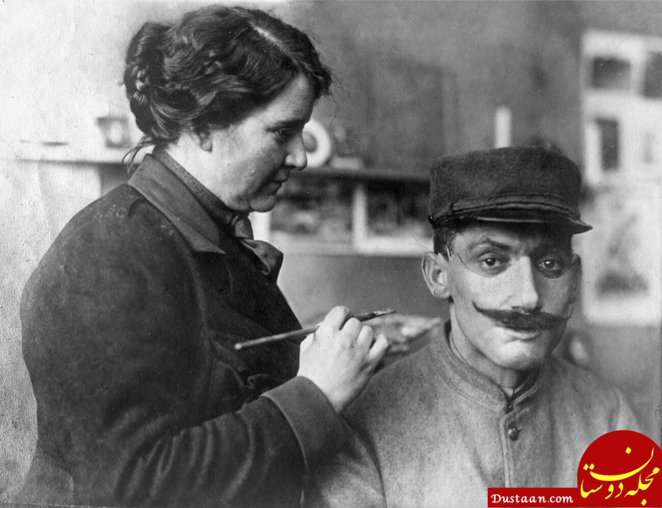 سال‌های جنگ جهانی اول: ماسک‌هایی تقریبا طبیعی برای سربازانی که صورتشان به شدت زخمی شده بود، طراحی می‌شد. در اینجا زنی به خانم “لد” در حال رنگ‌آمیزی یک ماسک دیده می‌شود تا کاملا با صورت سرباز زخمی تطابق داشته باشد.