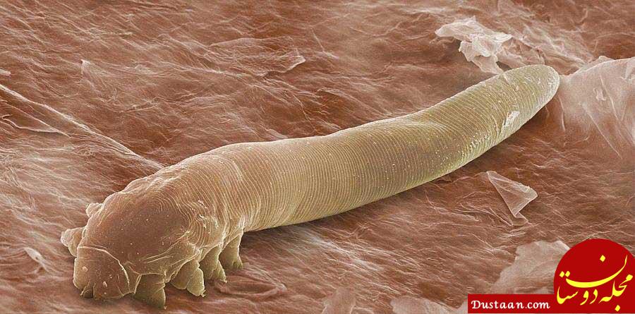 https://mihanpost.com/wp-content/uploads/2015/12/Demodex-folliculorum-4.jpg