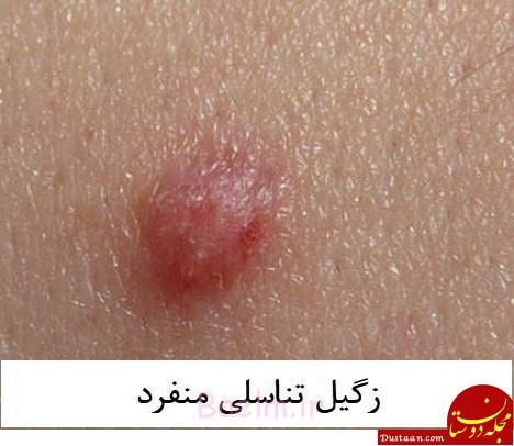 https://drshahnazamini.com/Portals/0/HPV-MG-1.jpg
