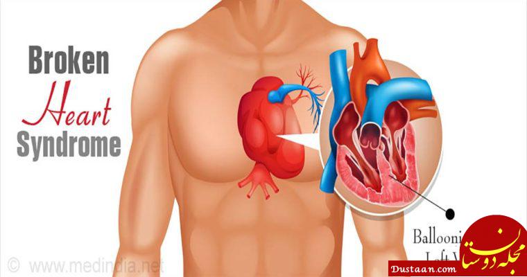 https://salamati.ir/wp-content/uploads/2016/12/broken-heart-syndrome-760x400.jpg