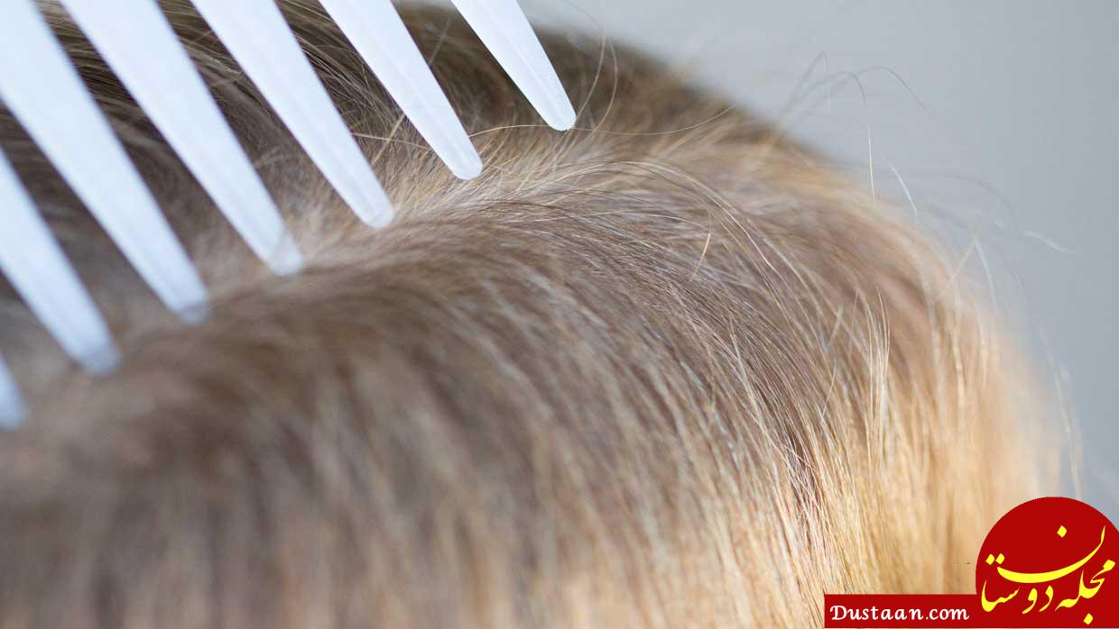 https://koorook.com/wp-content/uploads/2018/02/Kill-Head-Lice-Naturally-www.koorook.com-11.jpg