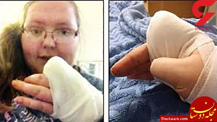 زن جوان از شدت درد انگشتش را با تبر قطع کرد! +عکس