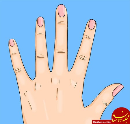 www.dustaan.com-هلال سفید روی ناخن ها از نگاه طب سنتی