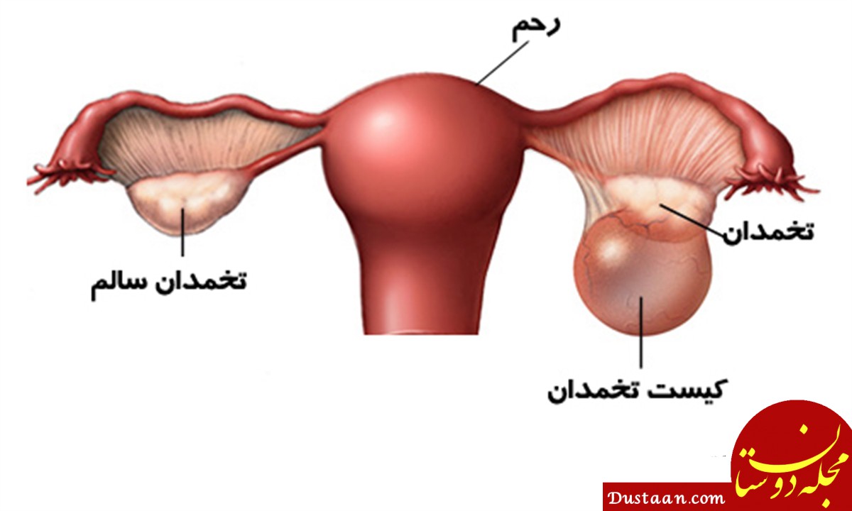 پیش‌نویس خودکار