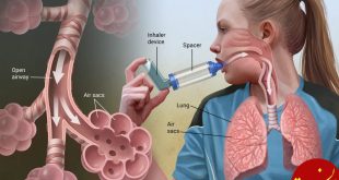 باید و نبایدهای اسباب‌كشی در مبتلایان به آسم