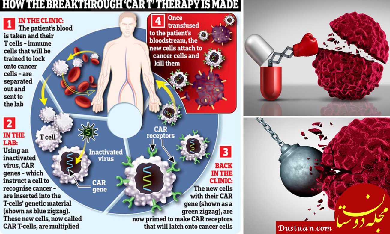 نتایج حیرت انگیز سلول درمانی CAR T-cell علیه سرطان